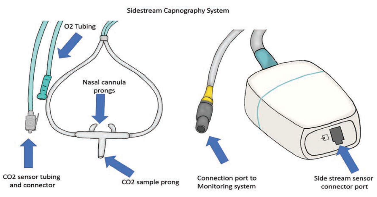 Waveform Capnography: Part of Comprehensive Vital Sign Monitoring